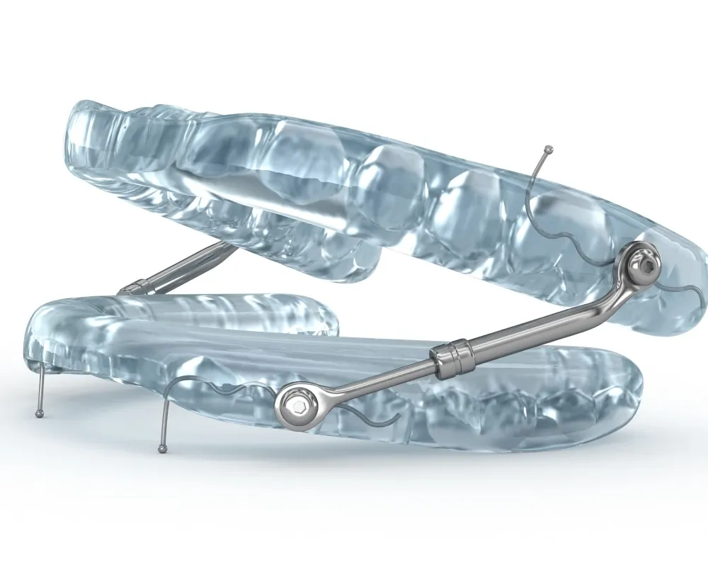 activateur croissance Orthodontiste enfant Strasbourg
