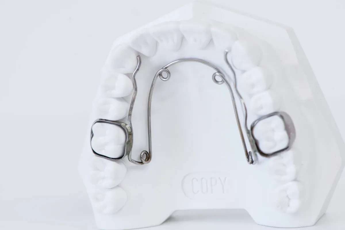 Quad Helix Orthodontiste enfant Strasbourg