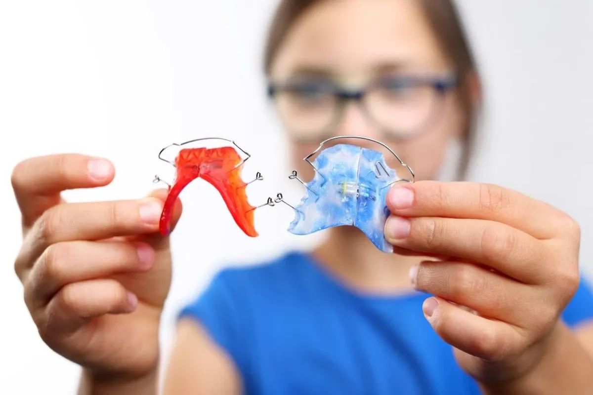 Plaque palatine amovible Orthodontiste enfant Strasbourg